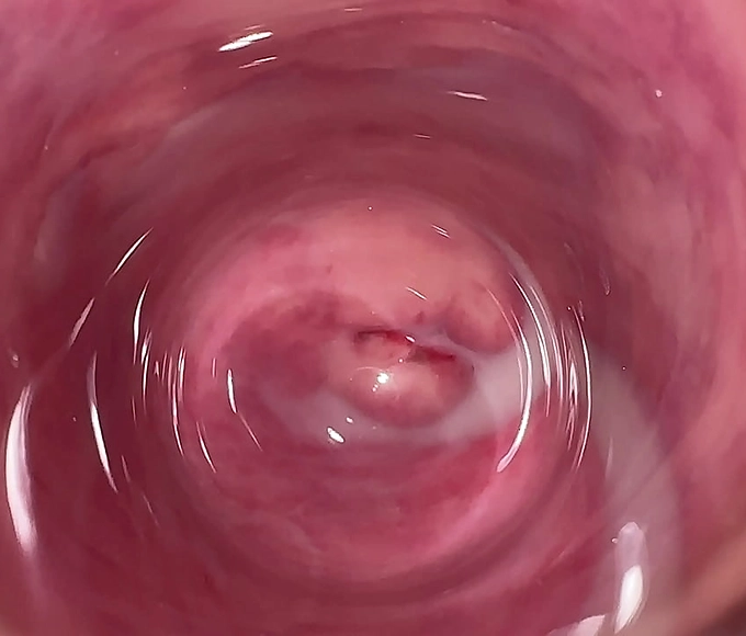 Revealing the Juiciest Pussy: Mia's Internal Camera Showdown!